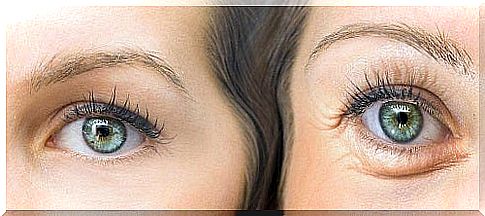 5 natural remedies for droopy eyelids