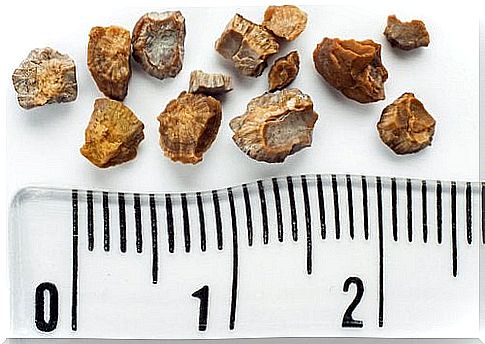 Ways to prevent the formation of kidney stones