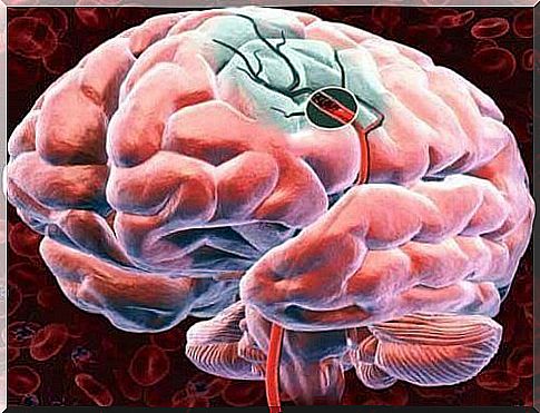 Cerebral blood flow: how can we stimulate it?