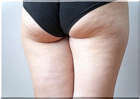 Need to use a cheap remedy for cellulite