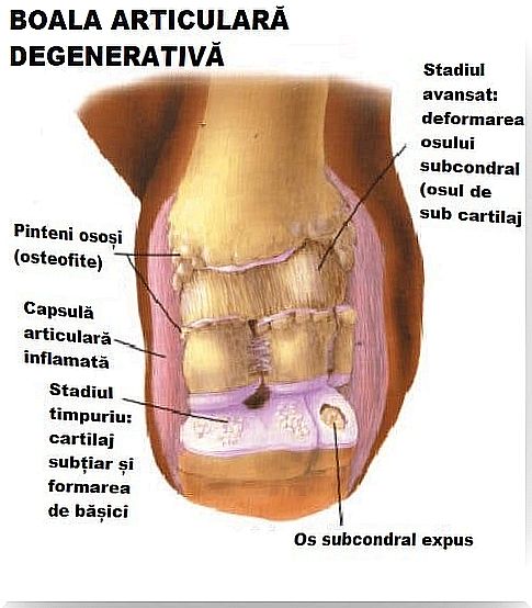 Degenerative joint disease: causes and treatment