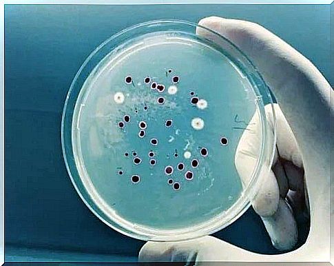 Characteristics of pityriasis versicolor observed under a microscope