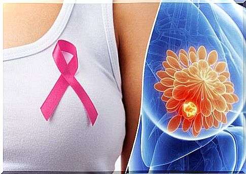 Early symptoms of breast cancer