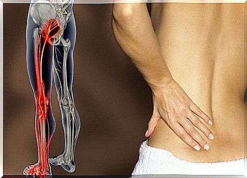 Exercises for sciatica pain