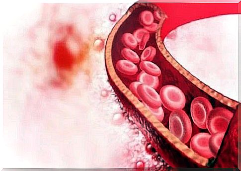 Arteries in the human body