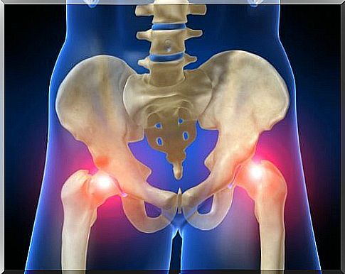  Hip pain can be caused by osteoarthritis