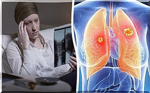 Lung cancer - risks for women