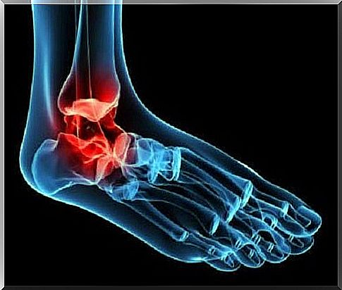 Osteoarthritis of the ankle can be caused by several factors