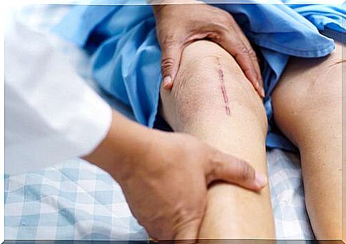 Recovery from knee arthroplasty