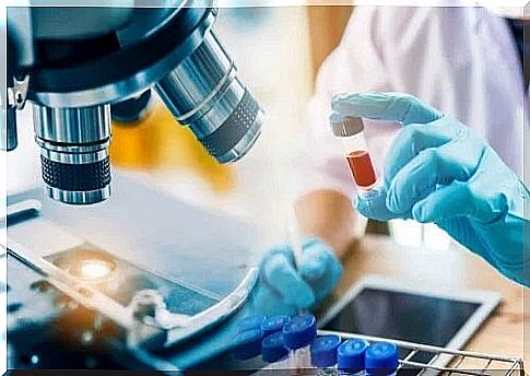 Symptoms of HIV infection analyzed in the laboratory