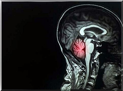 Types of treatment for brain metastases