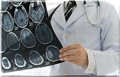 Physician examining traumatic brain injury